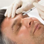 Lifting Facial: o que mudou nas técnicas nos últimos anos?